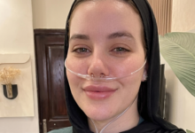 فضيحة
